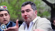 В центре Еревана задержаны двое политиков - одному из них разбили нос