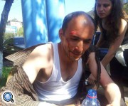 В Армении избит гражданский активист, вскрывший себе вены